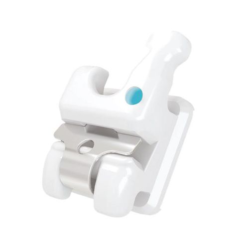 Bracket ortodontici in ceramica - Thomas C - Creative Dental