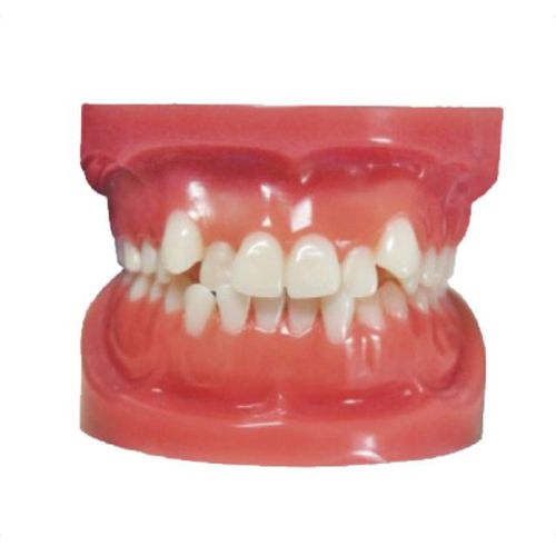 Tipodonto di dentatura - Angle Class I - Creative Dental - per cure odontoiatriche