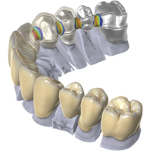 Software CAD - exocad - DOF, Inc. - odontoiatrico