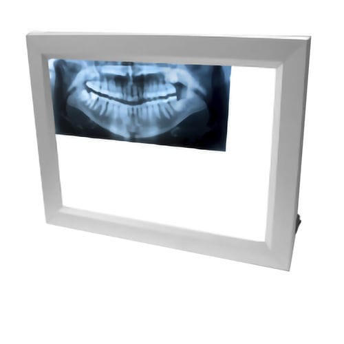 Negativoscopio 1 corpo - X-LED - ECLAIRE SRL - 2 corpi / 3 corpi / odontoiatrico