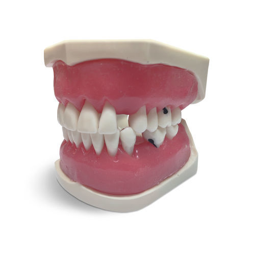 Modello anatomico gengivale - E56 - GF DENTAL - di dentatura / per cure odontoiatriche / ad uso didattico