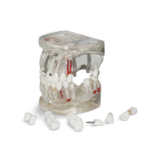 Modello anatomico di nervo - T04 - GF DENTAL - mandibolare / di denti / per implantologia