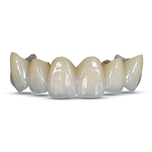 Materiale odontoiatrico in zircone - BruxZir® Esthetic - Glidewell Europe - per ricostruzione dentale
