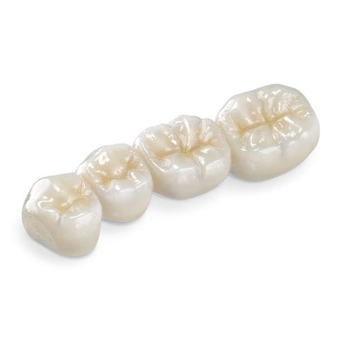 Materiale odontoiatrico in zircone - BruxZir® - Glidewell Europe - per ricostruzione dentale