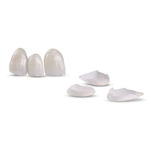 Materiale odontoiatrico in ceramica - Veneers - Glidewell Europe - in zircone / in disilicato di litio / per ricostruzione dentale