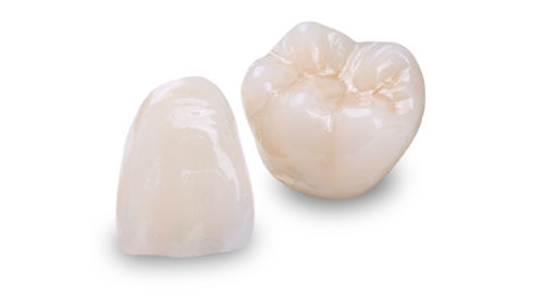 Materiale odontoiatrico in ceramica - Obsidian®  - Glidewell Europe - per ponti dentali / per corone dentali / per inlay