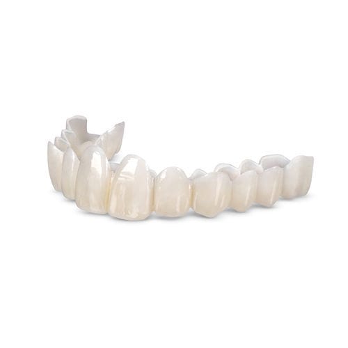 Protesi dentale in resina - Smile Transitions™ - Glidewell Europe - per denti anteriori / per denti posteriori / amovibile