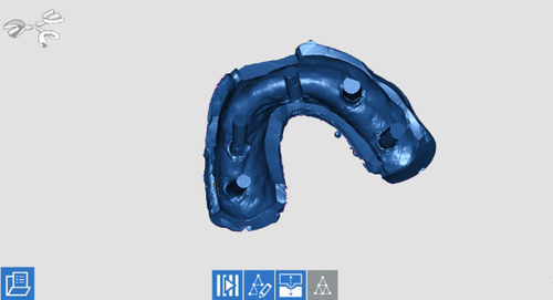 Software di acquisizione - OPTORC - Open Tech 3D Srl - odontoiatrico / di acquisizione / di supporto per prescrizioni