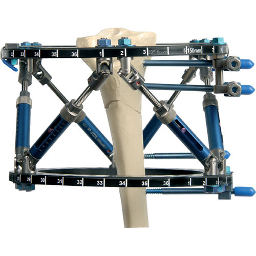 Fissatore esterno modulare - Smart Correction®  - Response Ortho - circolare / per adulti