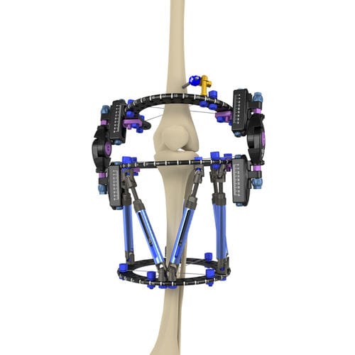 Fissatore esterno per ginocchio - Response Ortho - ibrido / per adulti