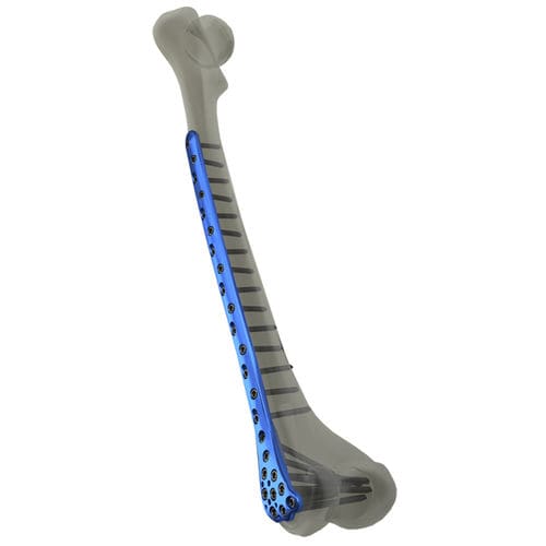 Placca di compressione per femore - Response Ortho - distale / bloccata / in metallo