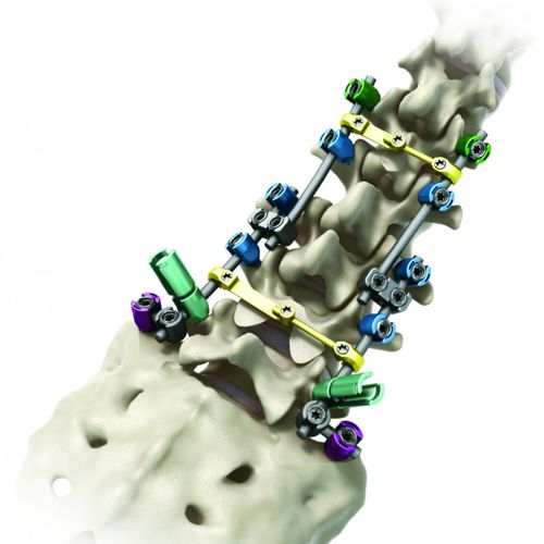 Sistema di osteosintesi toraco-lombo-sacrale - Streamline® TL - RTI Surgical - via posteriore / per adulti