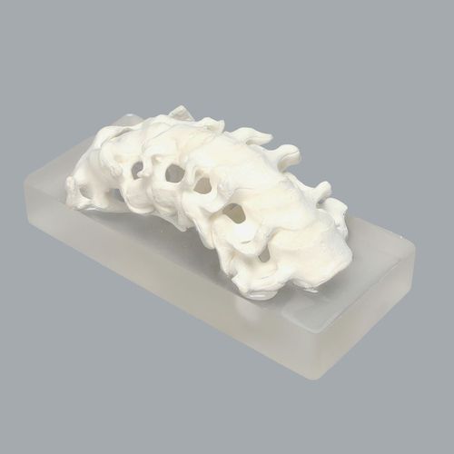 Modello anatomico di rachide - 1326-53 - Sawbones/Pacific Research Labs - colonna vertebrale cervicale / cervicale / di muscoli cervicali