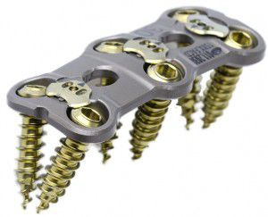 Placca per artrodesi cervicale - VAN GOGH™ - CTL Medical Corporation - bloccata / in metallo / 2 livelli