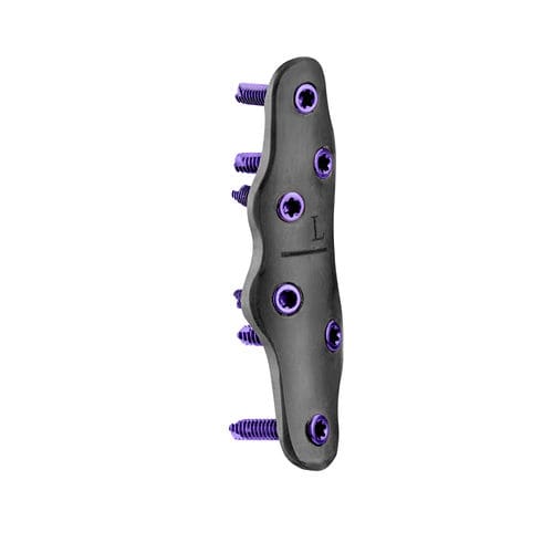 Placca per artrodesi per articolazione metatarso-falangea - CarboFix Orthopedics - bloccata / non bloccata / in metallo