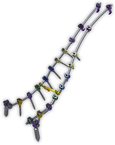 Sistema di osteosintesi toraco-lombo-sacrale - Lancer™ - ChoiceSpine - via posteriore / per adulti