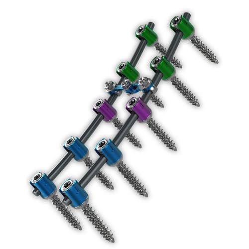 Sistema di osteosintesi toraco-lombare - Proliant® - ChoiceSpine - via posteriore / per adulti