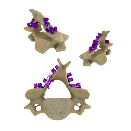 Placca per laminoplastica per vertebra cervicale - Blackbird™ HLS - ChoiceSpine - in metallo