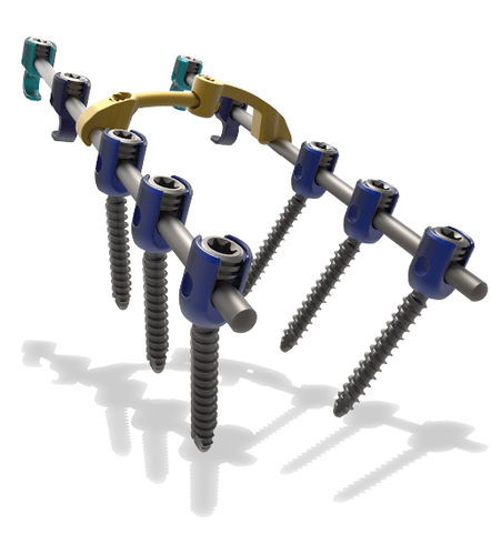 Sistema di osteosintesi cervico-toracico - Blackbird™ - ChoiceSpine - via posteriore / per adulti