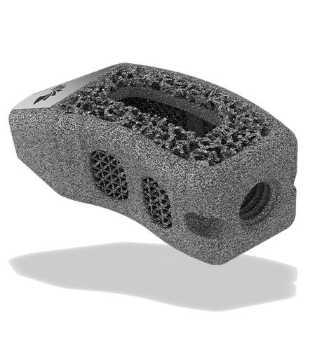 Gabbia intersomatica lombare - TigerShark® Threaded TL  - ChoiceSpine - via transforaminale / in titanio / stampata in 3D