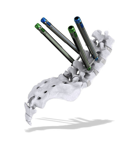 Sistema di posizionamento di viti peduncolari mininvasivo - Thunderbolt™ - ChoiceSpine