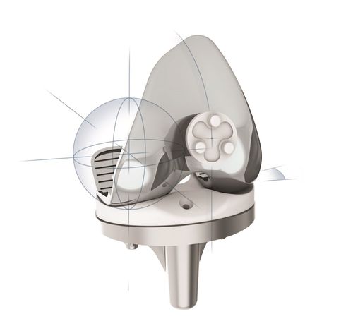 Protesi di ginocchio tricompartimentale - SAIPH® - MatOrtho - a piatto fisso / cementata o non cementata