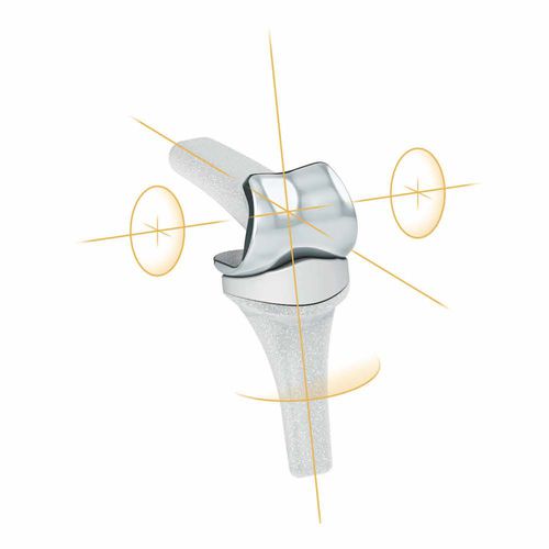 Impianto interfalangeo della mano - PIPR™ - MatOrtho