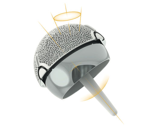 Protesi di testa del femore - ADEPT® - MatOrtho