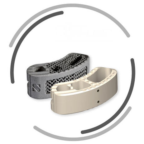 Gabbia intersomatica lombare - MOBIS II - Signus Medical - via transforaminale / in titanio / in PEEK