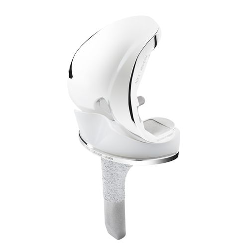 Protesi di ginocchio tricompartimentale - T.KAPS® - X-NOV Medical Technology - a piatto mobile / cementata o non cementata