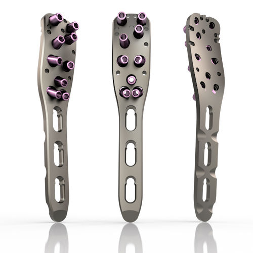 Placca di compressione per omero - 27 series - South America Implants - prossimale / bloccata / in metallo