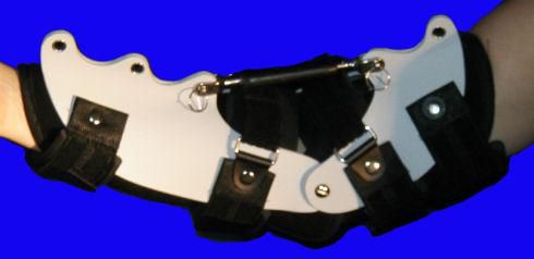 Steccobenda per gomito - Turnbuckle - Tiburon Medical Enterprises - L / M / S
