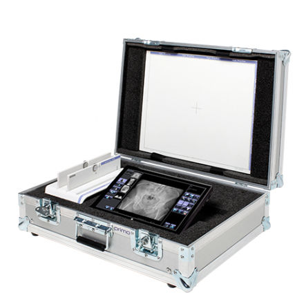 Sistema di acquisizione per radiografia - primo-W  - ATS - Applicazione Tecnologie Speciali - portatile