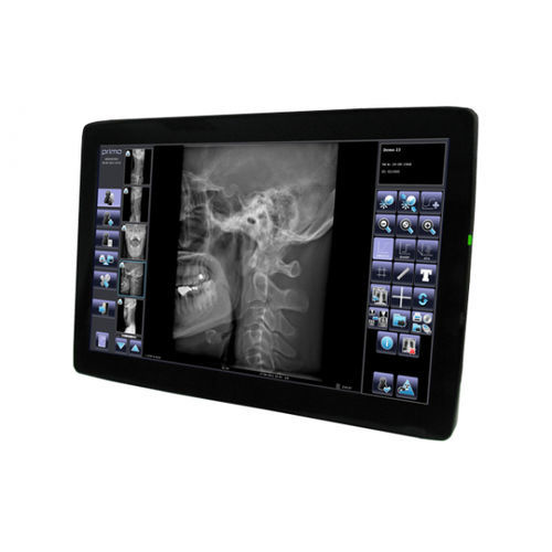 Sistema di acquisizione per radiografia - Primo  - ATS - Applicazione Tecnologie Speciali