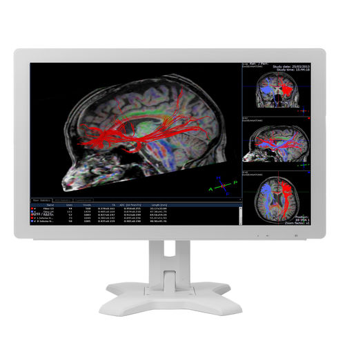 Monitor medico - MMS-21CAHST  - BriteMED Technology - per diagnostica per immagini / per simulazione medica / Full HD