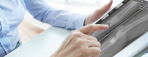 Software visualizzatore - ALPHATRON MEDICAL GmbH - medico / per ospedale