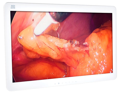 Monitor medico - MEGABYTE Systemhaus GmbH - chirurgico / Full HD / 4K