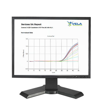 Software di analisi - Sentosa SA - Vela Diagnostics - di interpretazione / per biologia molecolare