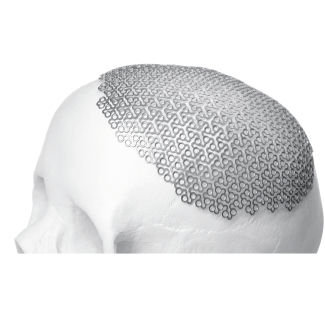 Impianto cranico - BioMesh®  - Bioplate