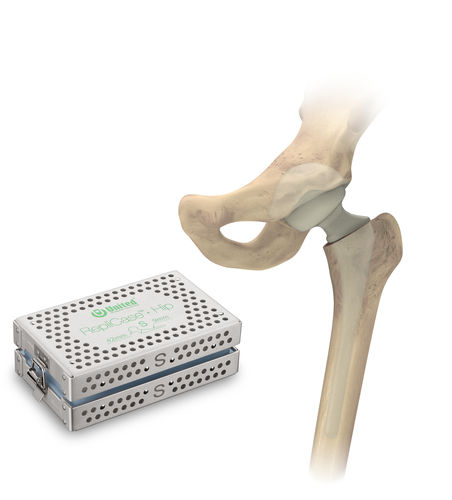 Spaziatore temporaneo per anca - RepliCase™ - US Orthopedics