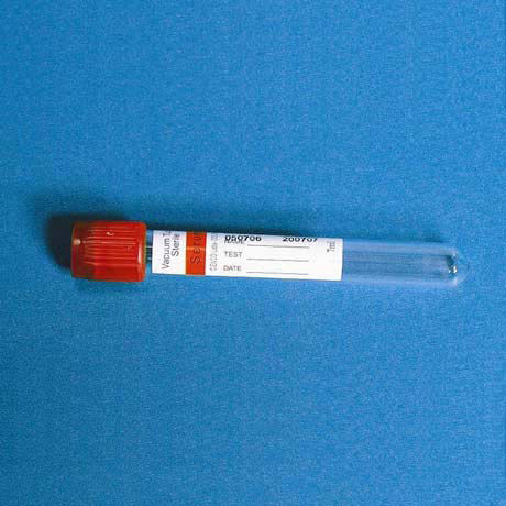 Provetta per prelievi di VES - TK-91xx series - TENKO MEDICAL SYSTEM CORP - cilindrico / di sangue / per prelievo campioni
