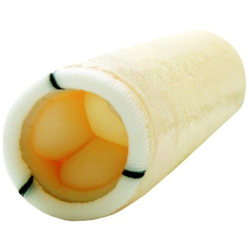 Bioprotesi vascolare aorta ascendente - SMOOTH 300 - Braile Biomedica - xenotrapianto / con valvola