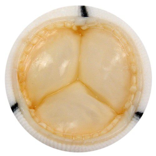 Bioprotesi valvolare polmonare - 8431 - Braile Biomedica - per valvola tricuspide / aortica / mitrale