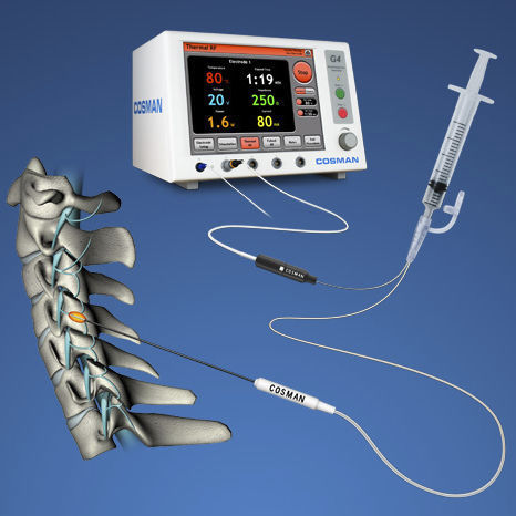 Elettrodo elettrochirurgico - CU - Cosman Medical - ago / riutilizzabile / monouso