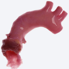 Bioprotesi vascolare aorta - CryoValve® - Cryolife - allotrapianto / con valvola