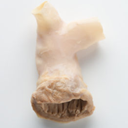 Bioprotesi vascolare arteria polmonare - CryoValve® SG - Cryolife - allotrapianto / con valvola