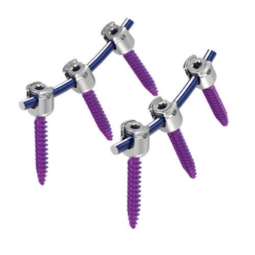 Sistema di osteosintesi toraco-lombare - MAS® - NuVasive - via posteriore / per adulti