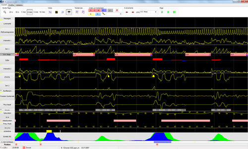 Software per ospedale - CIDELEC - per cure domiciliari / per polisonnografia / per poligrafia