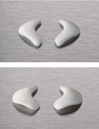 Impianto nasale - OP9519 - Matrix Surgical USA - anatomico / in polietiline