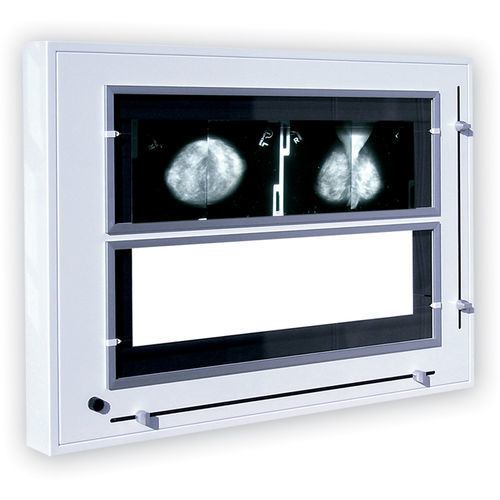 Negativoscopio 2 corpi - Rego X-ray - a luce bianca / per mammografia